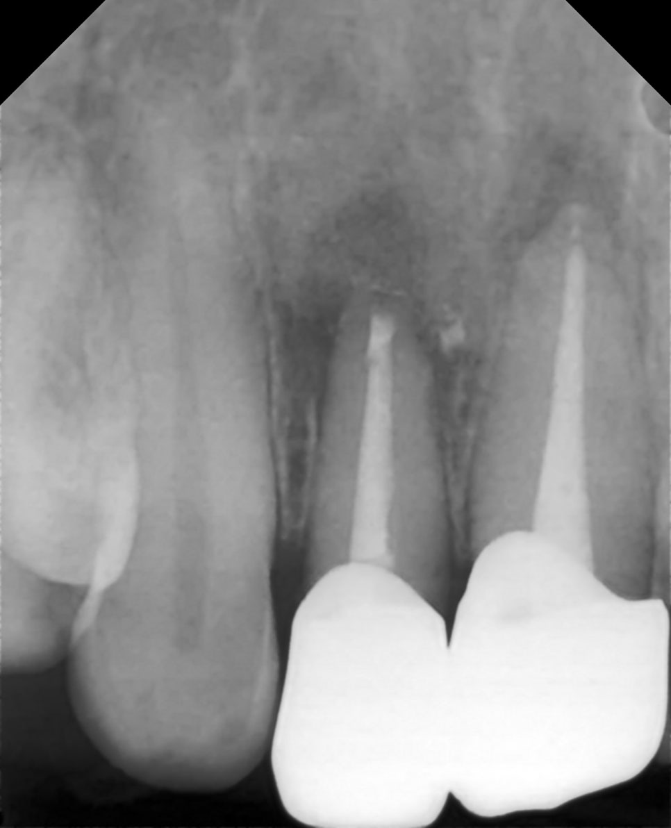 Treatment case image 4
