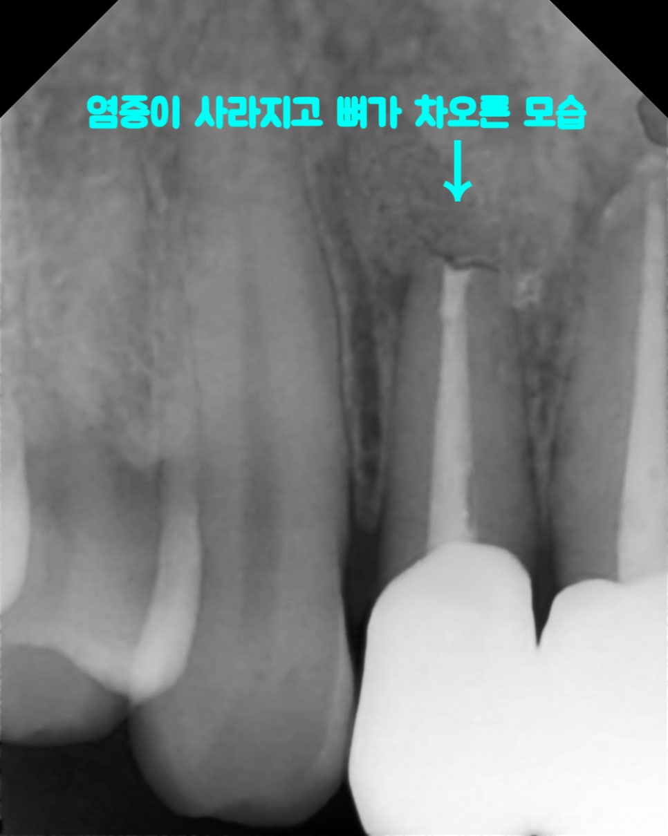 Treatment case image 6