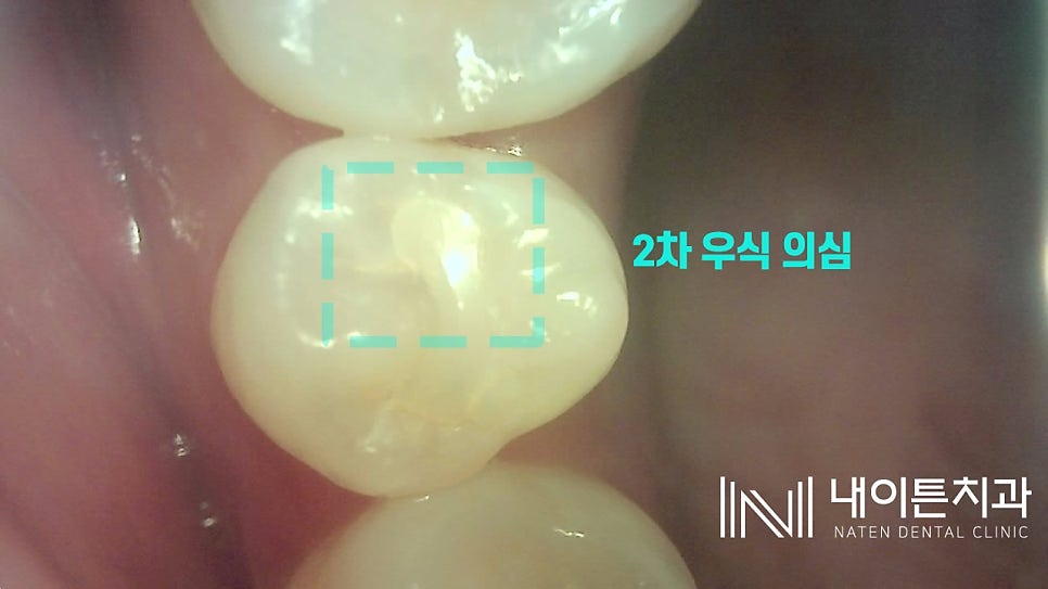 Treatment case image 1