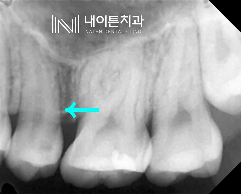Treatment case image 3