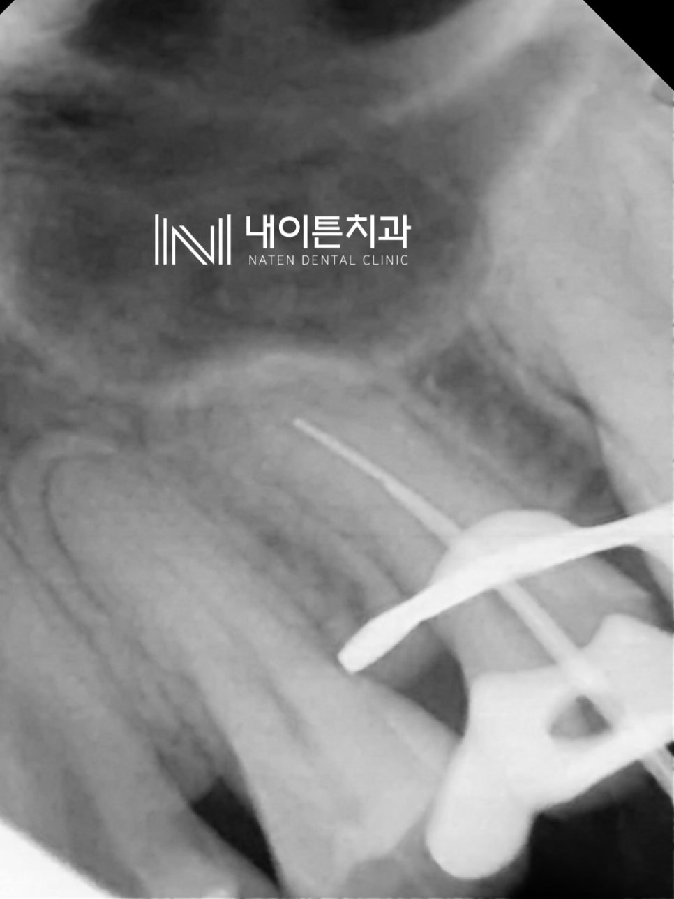 Treatment case image 13