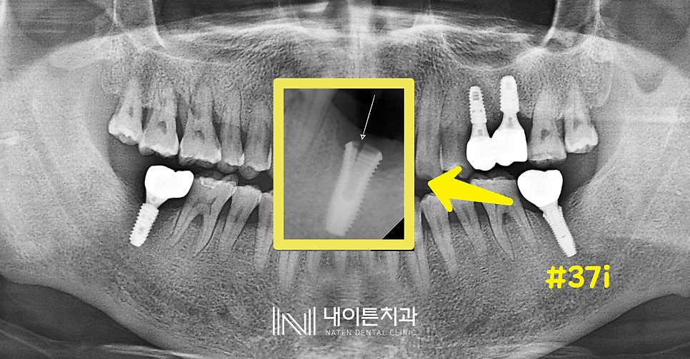 Treatment case image 1