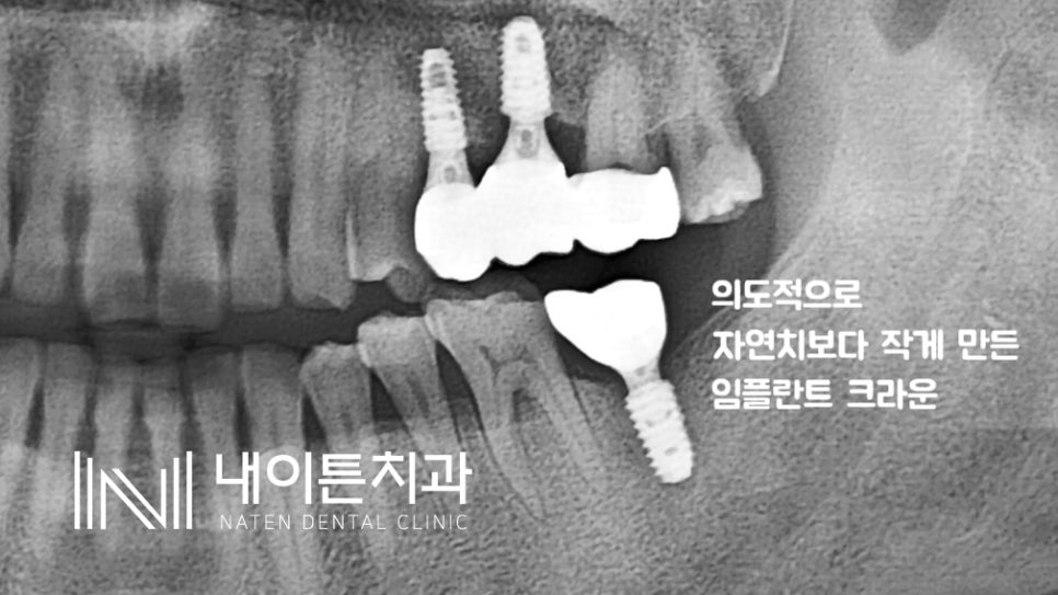 Treatment case image 10