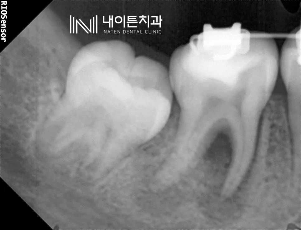 Treatment case image 1