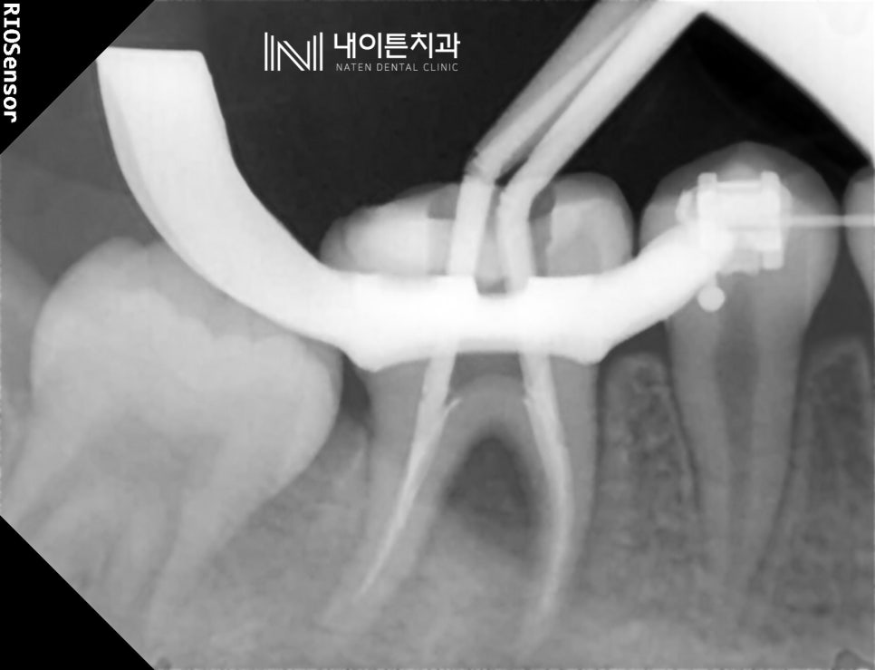 Treatment case image 3