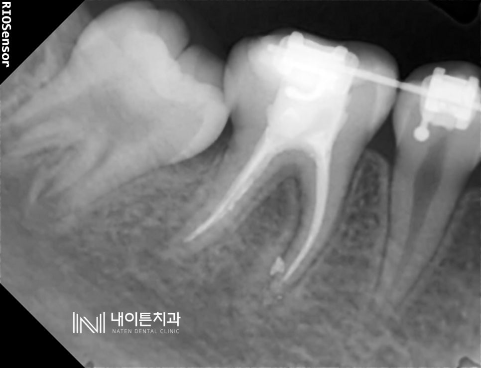 Treatment case image 7