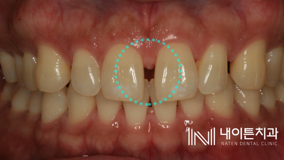 Treatment case image 1