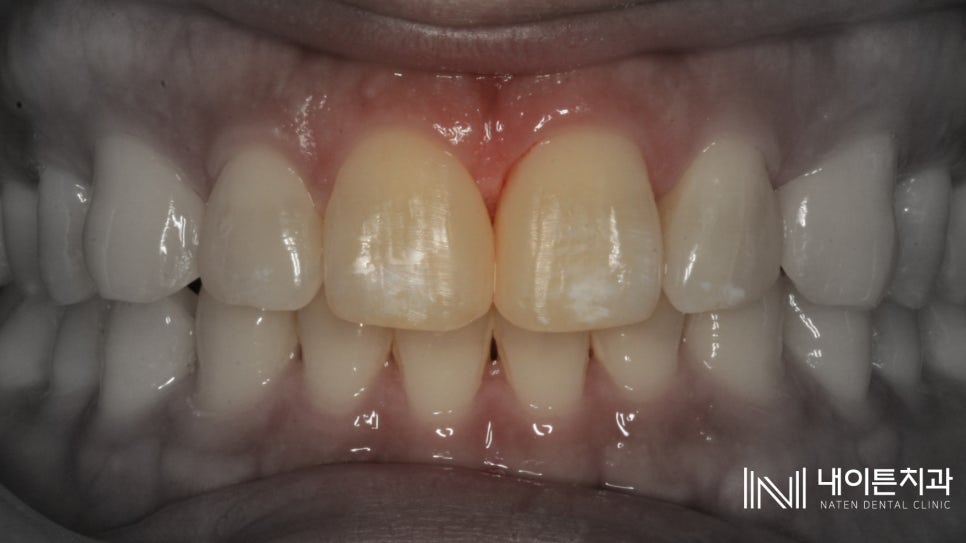 Treatment case image 7