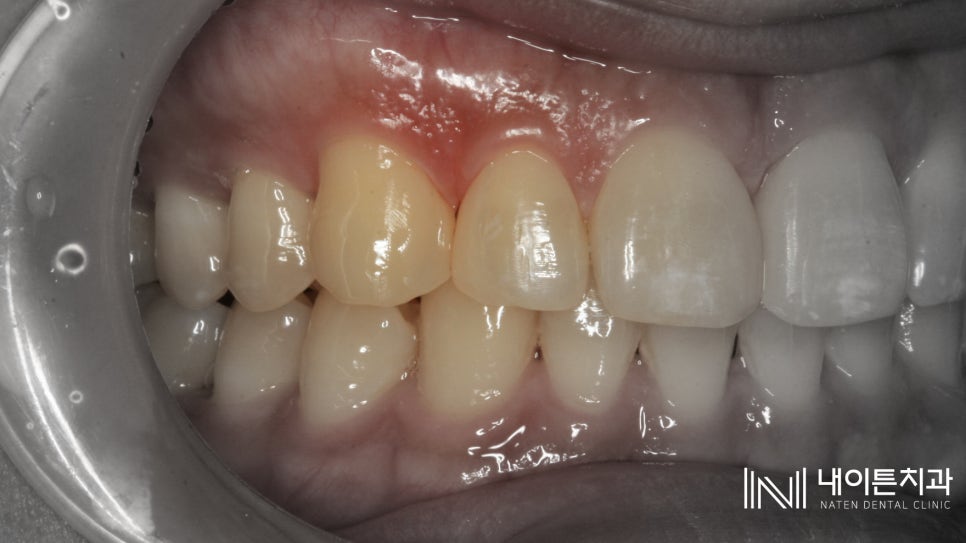 Treatment case image 8