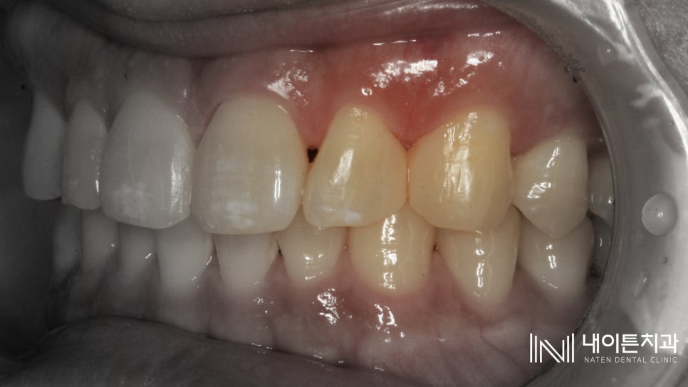 Treatment case image 9