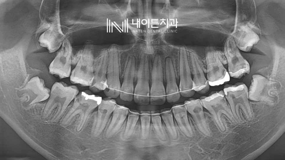 Treatment case image 4