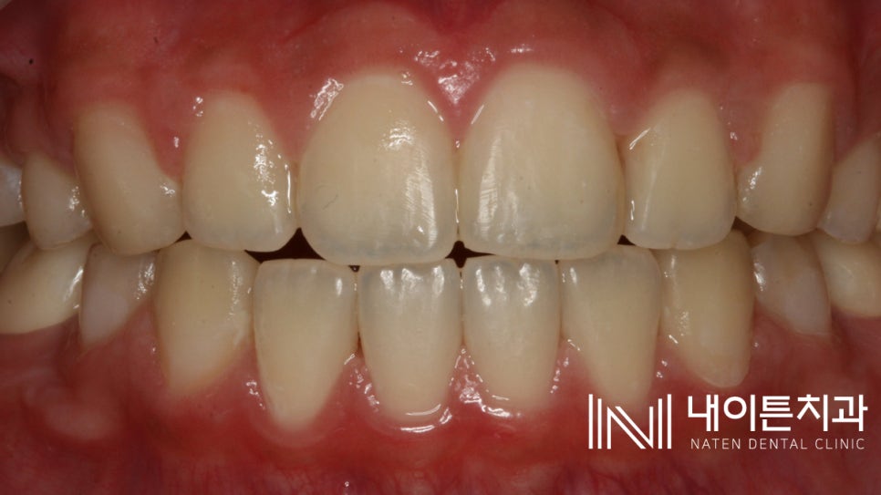 Treatment case image 9