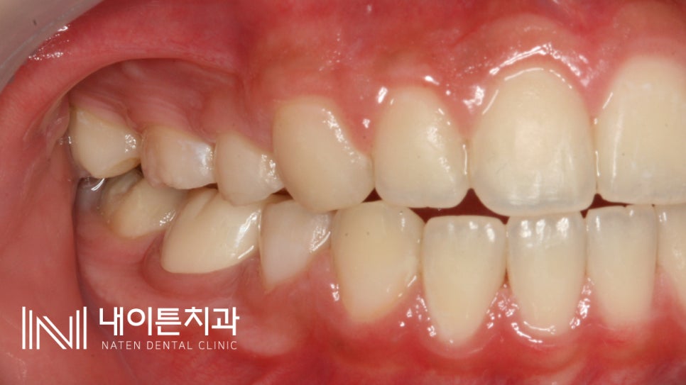 Treatment case image 10