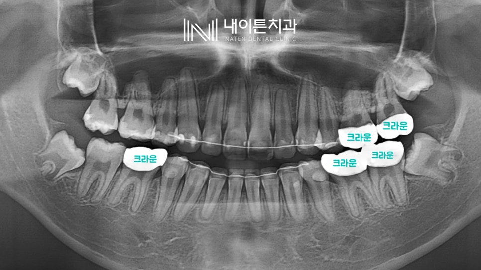 Treatment case image 12