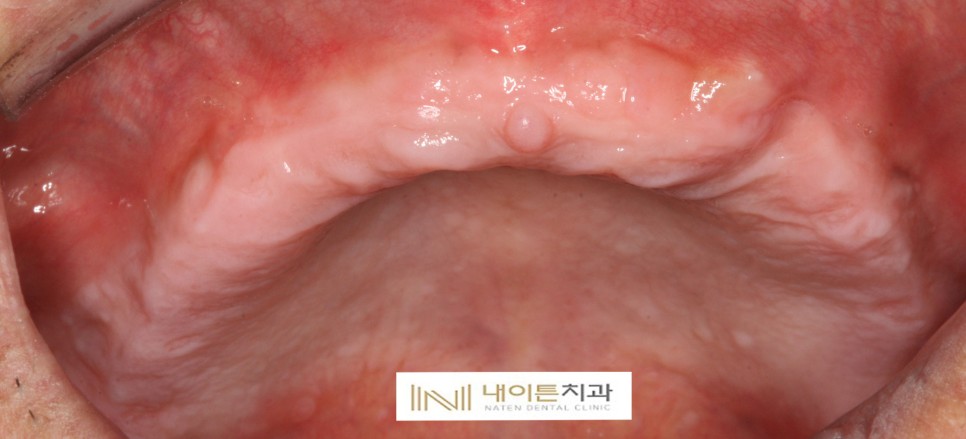 Treatment case image 2