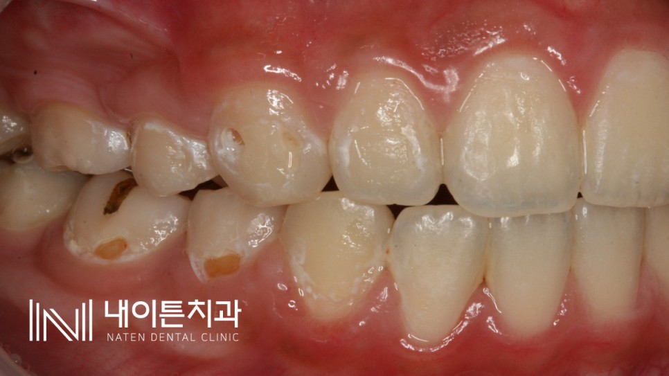 Treatment case image 3