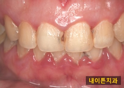 Treatment case image 4