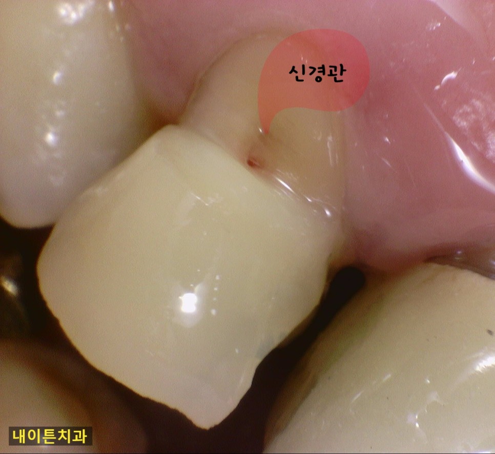 Treatment case image 6