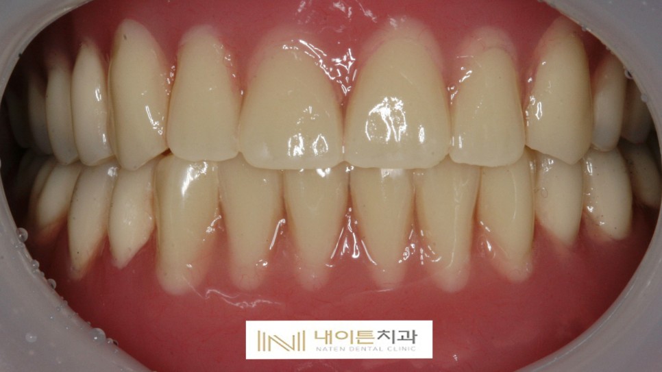 Treatment case image 7