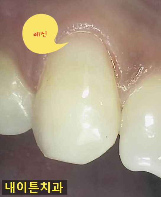 Treatment case image 9