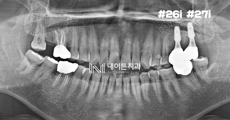 Treatment case image 1