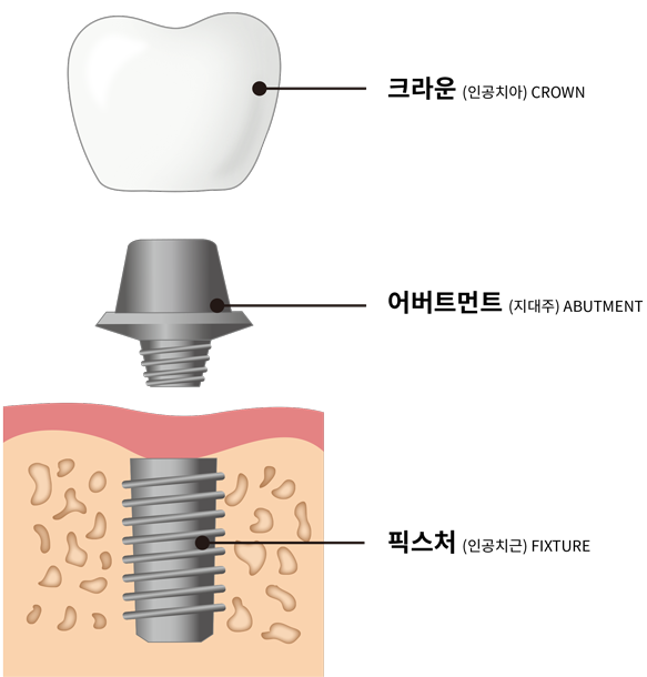 Treatment case image 2