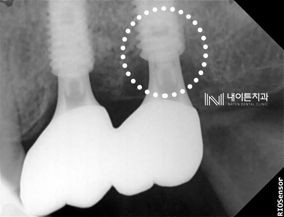 Treatment case image 3