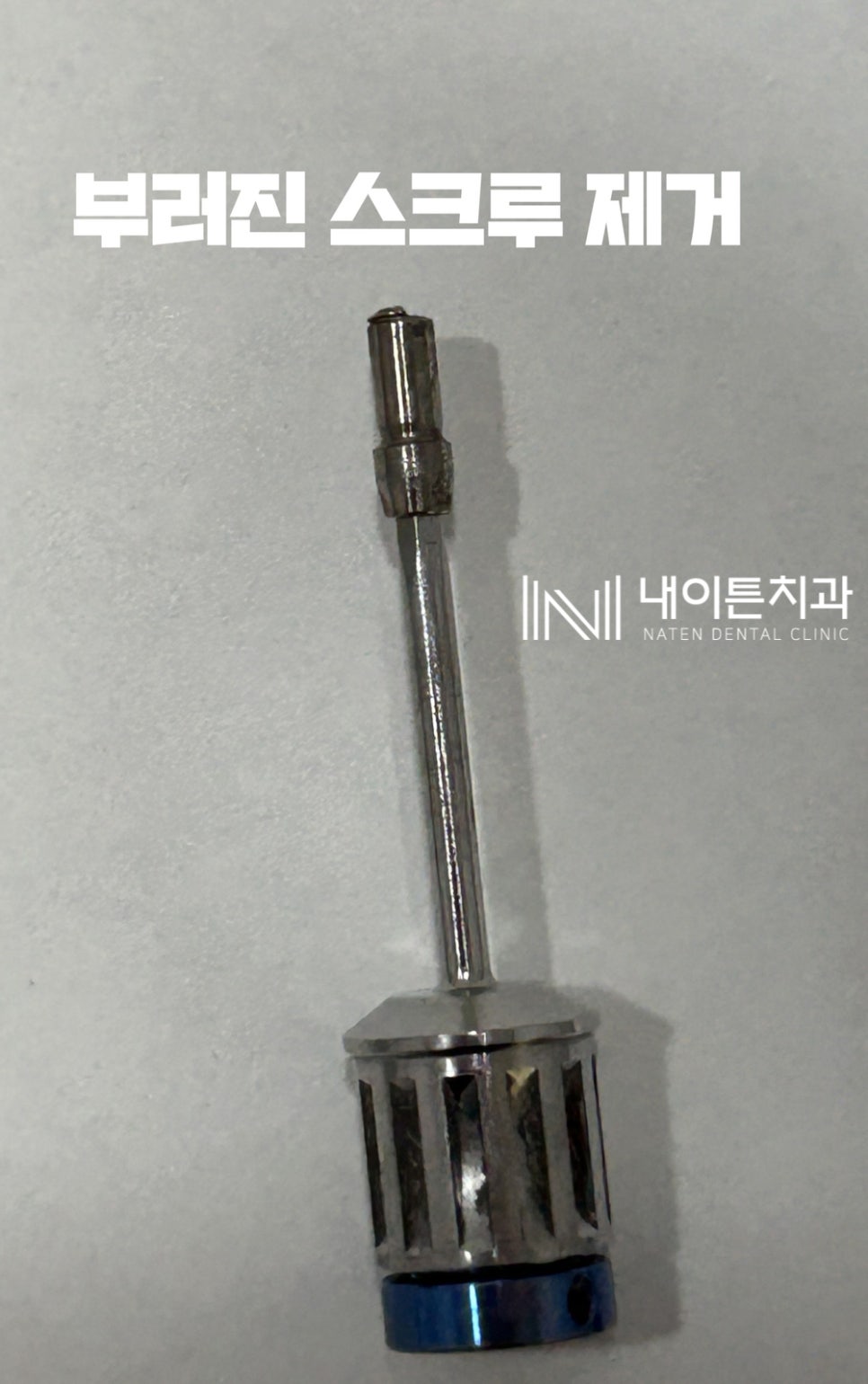 Treatment case image 6