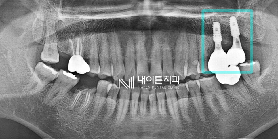 Treatment case image 8