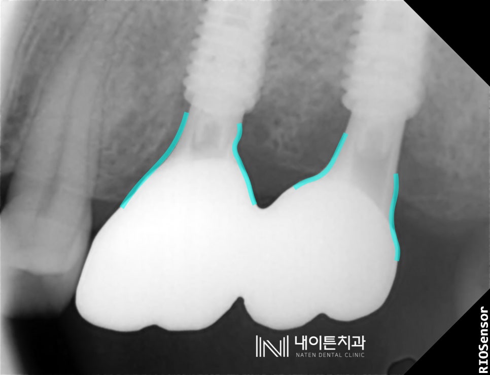 Treatment case image 9