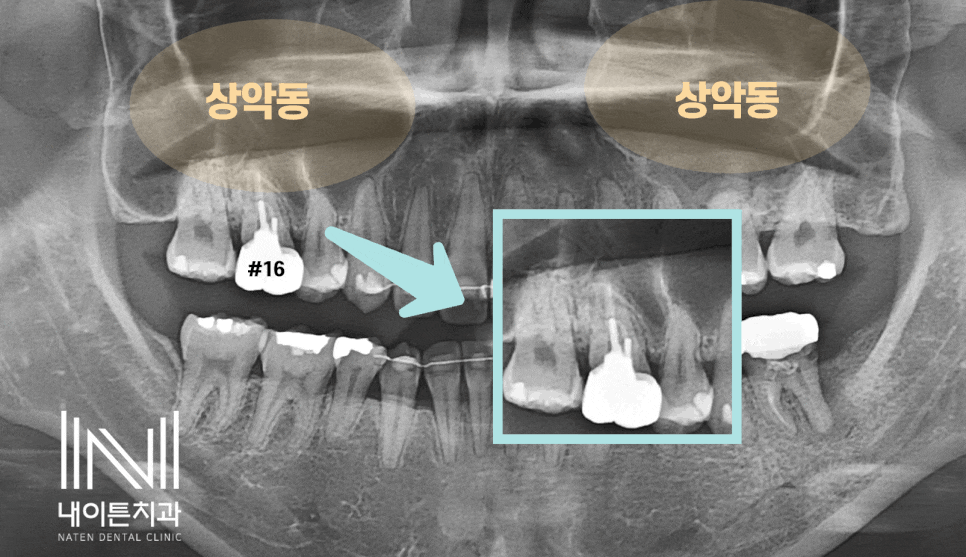 Treatment case image 2