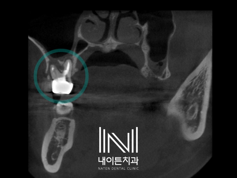 Treatment case image 3