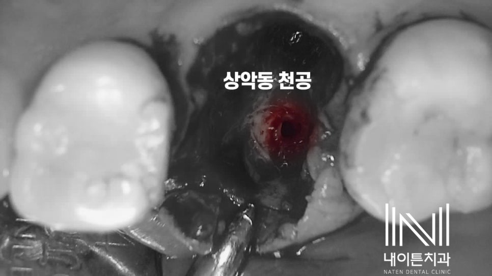 Treatment case image 4