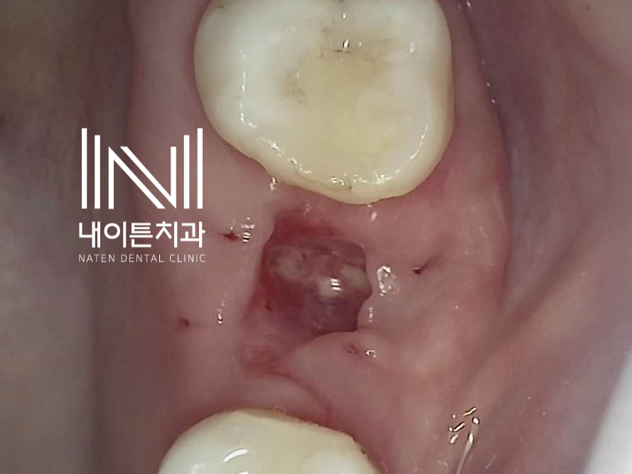 Treatment case image 6