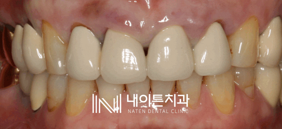 Treatment case image 1