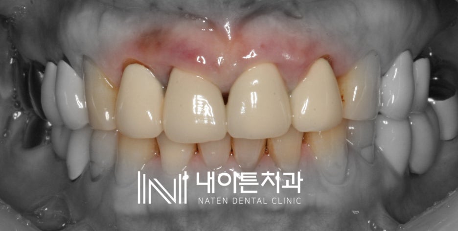 Treatment case image 2