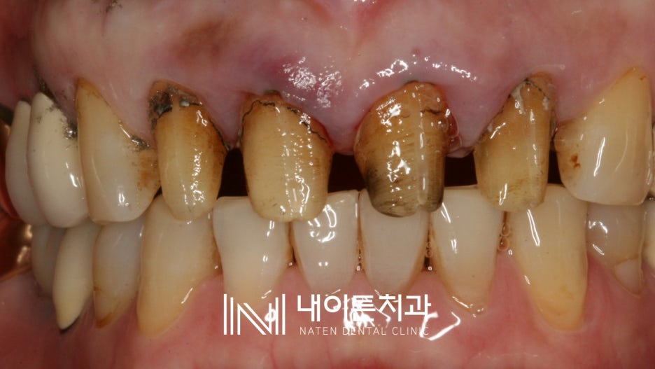 Treatment case image 3