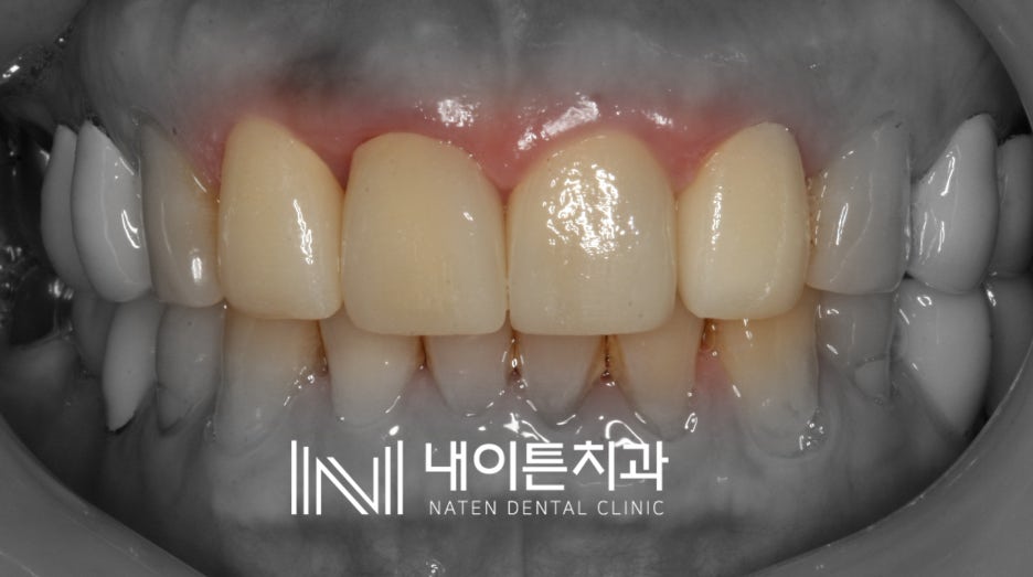 Treatment case image 4