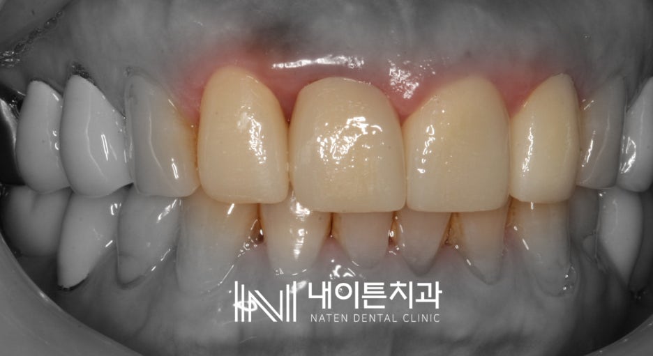 Treatment case image 5