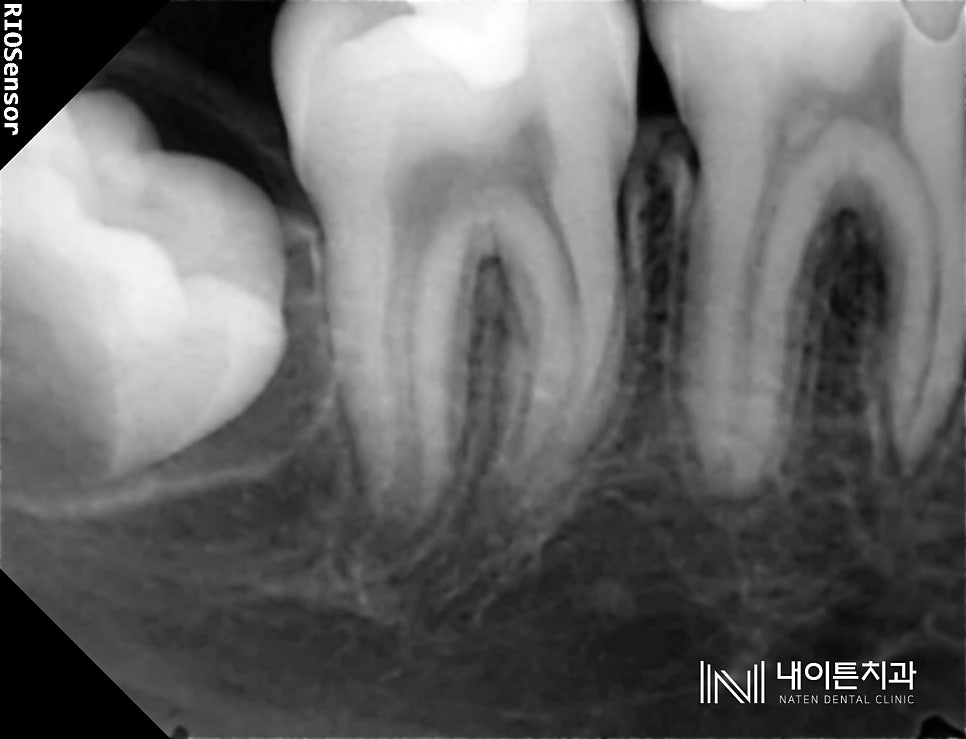 Treatment case image 7