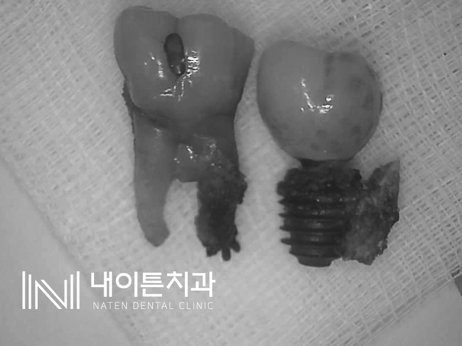 Treatment case image 3