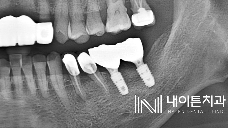 Treatment case image 8