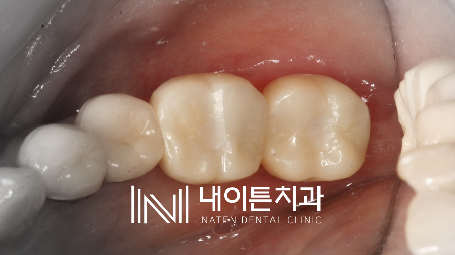 Treatment case image 10