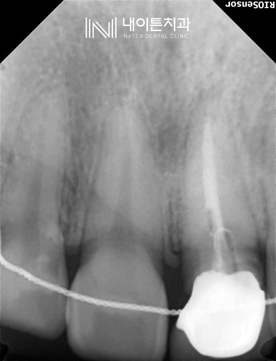 Treatment case image 3