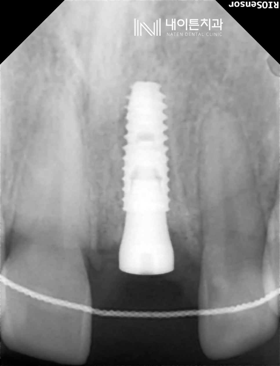Treatment case image 7