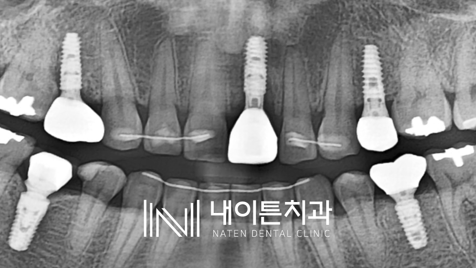 Treatment case image 9