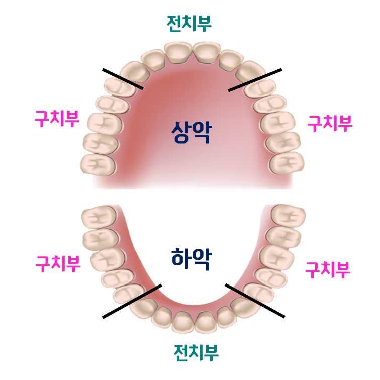 Treatment case image 1