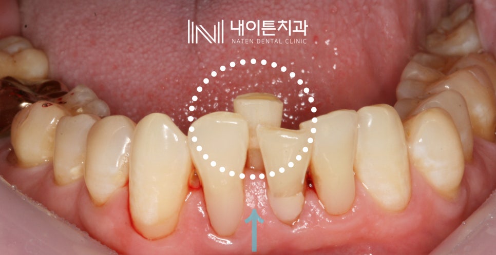 Treatment case image 2