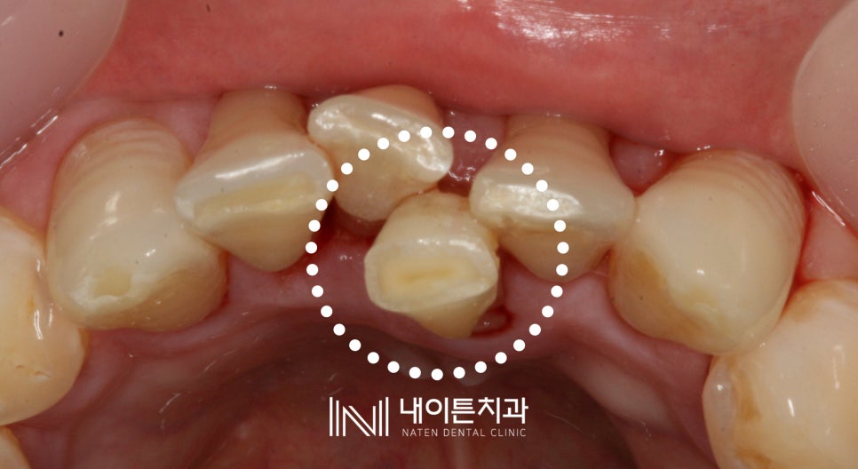 Treatment case image 4