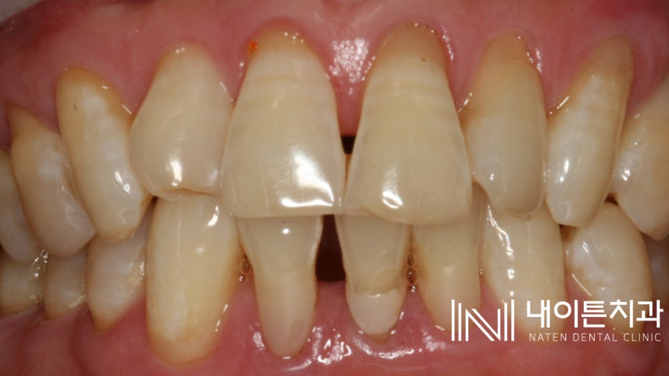 Treatment case image 5